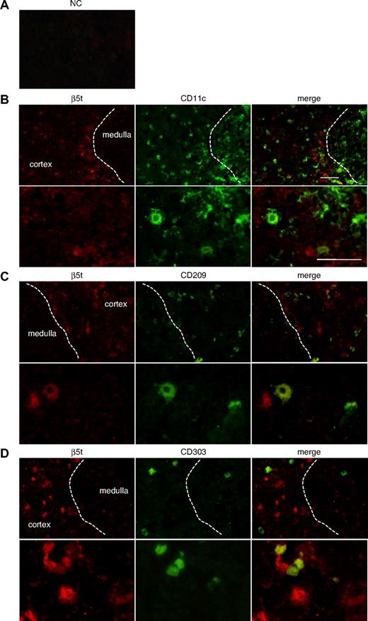 Figure 3. β5t is expressed in some thymic DCs. Neonatal thymic sections were immunostained for β5t and markers for DCs: (A) NC, (B) CD11c, (C) CD209, and (D) CD303. NC was stained with normal rabbit serum and biotinylated mouse IgG1. The lower half of each panel shows a magnified image of the cortical area. Bar represents 50 μM.