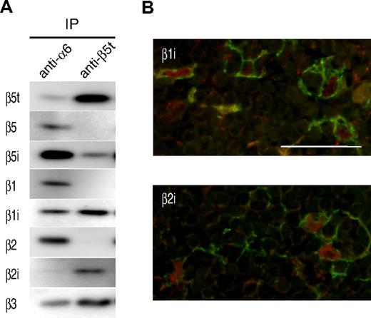 Figure 4. β5t is incorporated into 20S proteasomes with β1i and β2i in the human thymus. (A) Extracts of human neonatal thymi were immunoprecipitated with anti-α6 or anti-β5t Ab, followed by immunoblotting with the indicated Abs. IP indicates immunoprecipitation. (B) Immunofluorescence staining of the neonatal thymus using anti-β1i or anti-β2i Ab. Each panel shows an image of the cortical area. β1i and β2i (in red) are expressed in keratin-expressing cTECs (in green). Bar represents 50 μM.