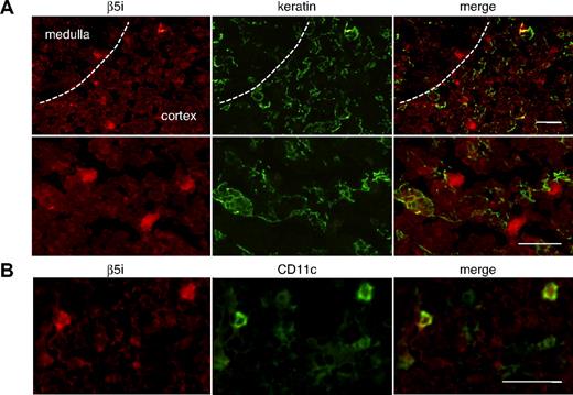 Figure 5. β5i is widely expressed in the human thymus. (A) β5i-expressing cells are distributed in both cortex and medulla and are not stained with Ab for keratin. The lower panel shows a magnified image of the cortical area. (B) Cells expressing β5i at high levels in the cortex are stained with Ab for CD11c. Thus, cortical DCs express β5i at high levels. Bar represents 50 μM.