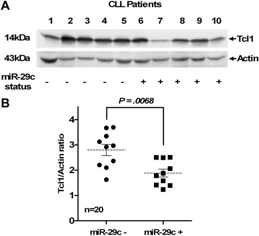 Figure 6. MiR-29c down-regulation is associated with higher level of Tcl1 oncogene. (A) Tcl1 protein levels in 10 CLL patients (5 miR-29c− and 5 miR-29c+) detected by Western blot analysis reveal an association between miR-29c down-regulation and a higher Tcl1 expression. (B) Two-dimensional densitometry was used to quantify Tcl1 and actin protein band expression. This figure states Tcl1/actin ratios in miR-29c− (n = 10) and miR-29c+ patients (n = 10). Statistical differences were assessed using the Mann-Whitney nonparametric test. The mean ratio in the 2 groups was plotted with their SEM.