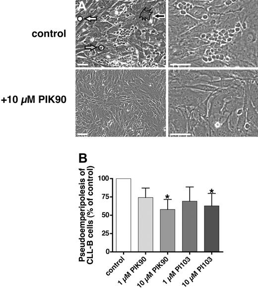 Figure 2. Reduction of spontaneous migration of CLL cells beneath marrow stromal cells (pseudoemperipolesis) by PIK-90 and PI-103. CLL B cells were preincubated with PIK-90 or PI-103 and seeded onto confluent marrow stromal cell layers. After overnight incubation, the CLL cells that had not migrated into the stromal cell layer were vigorously washed off. Then, CLL B cells that migrated beneath the stromal cells were microphotographed (A) and quantified by flow cytometry (B). In phase-contrast, pseudoemperipolesis is characterized by the dark appearance of CLL cells that have migrated into the same focal plane as the stromal cells. Cells were imaged in medium using a phase-contrast microscope (Model ELWD 0.3; Nikon, Garden City, NY) with a 10×/0.25 NA objective lens. Images were captured with a Nikon D40 digital camera (Nikon, Tokyo, Japan) using Camera Control Pro software (Nikon Japan); when necessary, Adobe Photoshop 9.0 (Adobe Systems, San Jose, CA) was used for image processing. (A) Representative phase-contrast photomicrographs of pseudoemperipolesis of untreated CLL cells, labeled “control,” and, in comparison, reduced pseudoemperipolesis of the same CLL sample pretreated with 10 μM PIK-90 (bottom row). White bars in the left panels represent 100 μM (100× magnification); bars in the right panels, 50 μM (400× magnification); white filled arrow, a nonmigrated CLL cell; gray filled arrow, a migrated CLL cell; black filled arrow, a marrow stromal cell (framed). In panel B, each bar represents the mean (± SEM) relative number of migrated CLL cells from 4 different patients after pretreatment with the agents displayed on the horizontal axis, compared with the untreated controls. *Significant inhibition with P values less than .05.