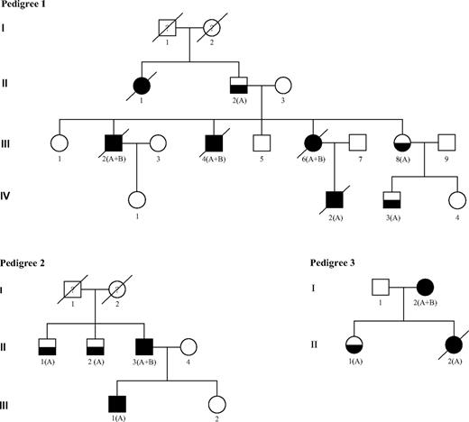 Figure 1. FPD/AML pedigrees. Squares indicate male and circles indicate female. Open symbols represent unaffected persons, half-filled symbols represent persons affected by FPD, and closed symbols represent persons affected by FPD who developed acute leukemia. The letters A and B indicate that a germline RUNX1 mutation and an acquired RUNX1 alteration could have been identified, respectively. Person III-1 in pedigree 2 developed T-ALL and person II-2 in pedigree 3 developed T-ALL followed by AML 5 years later. Both are also denoted with a closed symbol.