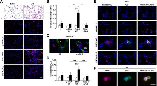 Figure 6. ENO-1 overexpression facilitates recruitment of monocytic cells to the alveolar compartment of LPS-treated mice. BALB/c mice were challenged intratracheally with either saline or LPS (0.5 mg/kg b.w.). After 24 hours, mice received an intravenous injection of PKH26-PCL–labeled (red color) stably transfected U937 cells (5 × 106 in a total volume of 100 μL PBS). Mice were then killed 5 hours after injection. (A) Representative lung tissue sections from saline- (left panel) or LPS- (right panel) treated mice injected with untransfected cells (−), mock-transfected cells (pcDNA3.1), cells overexpressing ENO-1 wild-type (ENO-1WT), or cells overexpressing ENO-1 lacking the plasminogen binding site (ENO-1ΔPLG). Original magnification ×20. Bar size 20 μm. Insert, original magnification 63×/1.32-0.6 oil objective. (B) Relative intensity of red/blue staining presented in panel A. Relative intensity of red/blue staining was determined by counting 4 randomly chosen fields per section using 3 independent sections for each group. □ represents saline-treated animals, while ■ represents LPS-treated mice. **P < .01; ***P < .001 (C) Localization of PKH26-PCL–positive monocytic cells overexpressing ENO-1WT (red color) within the alveolar wall. Sections were immunostained with the endothelial marker von Willebrand factor (VWF; green color; left panel) or with the alveolar epithelial type II cell marker prosurfactant protein-C (pro-SP-C; green color; right panel). EC indicates endothelial cells; and ATII, alveolar epithelial type II cells. Original magnification 63×/1.32-0.6 oil objective. Bar size 5 μm. (D) Fluorescence signal from PKH26-PCL–labeled monocytic cells present in bronchoalveolar lavage fluids obtained from saline- (□) or LPS- (■) treated mice. Mean values ± SD are reported; with n = 10 for each group; ***P < .001. (E) Representative lung tissue sections from LPS-treated mice injected with PKH26-PCL–labeled (red color) untransfected cells (−), mock-transfected cells (pcDNA3.1), cells overexpressing ENO-1 wild-type (ENO-1WT), or cells overexpressing ENO-1 lacking the plasminogen binding site (ENO-1ΔPLG) stained for PLG (green color). Original magnification 40×/1.25-0.75 oil objective. Bar size 10 μm. (F) Cellular localization of ENO-1 and PLG in U937 cells overexpressing ENO-1 recovered from bronchoalveolar lavage fluid of LPS-treated mice. Original magnification 63×/1.32-0.6 oil objective. Bar size 5 μm.