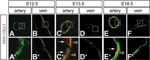 Figure 1. DLL1 expression in fetal arteries. DLL1 (red) is highly expressed in the endothelium (arrows in C′ and E′) and in the smooth muscle layer (arrowheads in C′ and E′) starting at embryonic day (E) 13.5 in arterial vessels, but not in veins (D). At E12.5, there is no detectable expression in arteries or veins (A,B). This pattern persists until E18.5 (E,F). A′ to F′ shows magnifications of panels A through F. Green indicates antibody staining for α-smooth muscle actin.