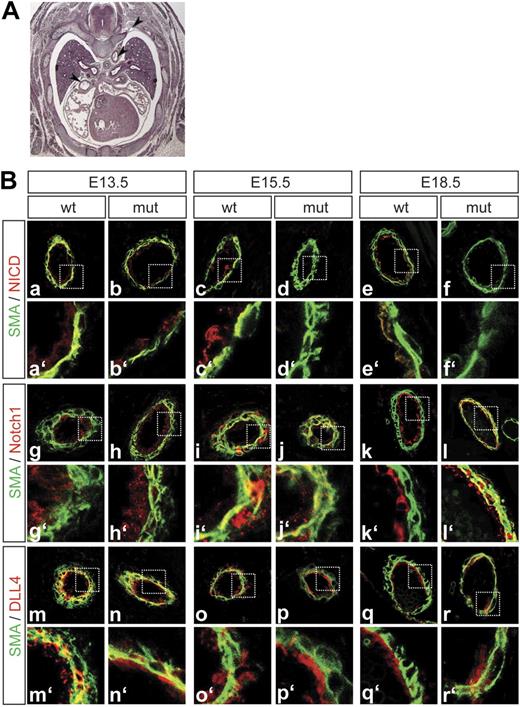 Figure 2. Notch1 activation is reduced in Dll1 mutants. (A) Histologic section of an E15.5 embryo indicating the level along the anterior-posterior body axis used for the analysis of the fetal vessel phenotype. (B) Antibody staining for cleaved Notch (a-f), full-length Notch1 (g-l), and DLL4 (m-r). Green: α-smooth muscle actin, red indicates antigen. Notch activation is abolished in Dll1 mutant embryos at E15.5 and E18.5 (c-f), whereas Notch1 and DLL4 are still expressed at these embryonic stages (g-r). At E13.5, mutant vessels show expression patterns of the analyzed markers similar to wild type (a,b,g,h,m,n). Although DLL4 is normally expressed it does not seem to be able to activate Notch1. a′ to r′ show magnification of the boxed areas indicated in subpanels a through r.