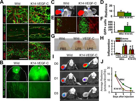 Figure 7. K14-VEGF-C transgenic mice display greater inflammatory cell migration and faster resolution of inflammation. (A) Coimmunostaining of LYVE-1 and CD31 in whole mounted (top panels) and sectioned (middle panels) ear skin and paracortical regions of sectioned DLNs (bottom panels) in K14-VEGF-C (K14-VC) and wild-type mice. Scale bars represent 50 μm. (B) FITC-conjugated dextran (3 μL) was intradermally injected into the ear skin (○), and 5 minutes later the distribution of FITC was visualized by a fluorescence stereomicroscope. Bottom panels show higher magnifications. (C,D) At day 3 after the injection of LPS, 3 μL FITC-conjugated dextran was intradermally injected into the inflamed skin. Fluorescence intensities were determined in DLNs at 30 minutes after the injection using IVIS, quantified, and presented as relative radiance (photon/sec per cm2/steradian). (E,F) At day 3 after intradermal injection of LPS, the GFP+ inflammatory cells (∼ 106 cells) were injected intradermally into the inflamed skin. Twelve hours later, the DLNs were sectioned and immunostained for LYVE-1. Scale bars represent 50 μm. The GFP+ inflammatory cells in the DLNs were quantified and presented as AU. (G,H) At day 6 after intradermal injection of LPS, ears were photographed, and the severities of erythema and swelling were scored. All bars represent mean ± SD from 4 to 5 mice. *P < .05 versus wild type. (I,J) At days 0, 1, and 3 after the injection of FITC-LPS, the remaining FITC-LPS was quantified using IVIS and presented as relative radiance (photons/sec per cm2/steradian). All dots represent mean ± SD from 4 to 5 mice. *P < .05 versus wild type; #P < .05 versus LPS in wild type.