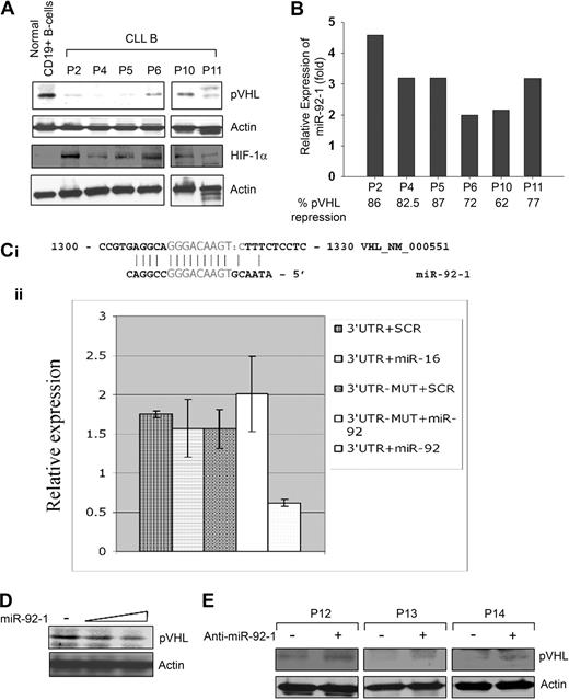 Figure 3. Endogenous prNL levels and regulation 6, miR 92-1. (A) CLL B cells express a low level of pVHL. CLL B-cell lysates (n = 6) were analyzed for endogenous expression of VHL by Western blot using an antibody to pVHL. Purified CD19+ B cells were used as control for comparison. Similarly, HIF-1α expression in these CLL B-cell lysates was also examined using a specific antibody to HIF-1α. Actin was used as a loading control. (B) CLL B cells overexpress miR-92-1. Expression levels of mature miR-92-1 in CLL B cells were measured by real-time RT-PCR using specific primers. Total RNA was extracted from the same primary CLL B cells (n = 6) used for the Western blot analysis of pVHL as indicated, and purified CD19+ (> 98%) normal B lymphocytes. The single-tube TaqMan microRNA assays were performed to quantify mature miR-92-1 and normalization was performed with RNU6B in triplicate. Relative expression (fold) was calculated using the comparative Ct method, where the expression of miR-92-1 in normal B cells was arbitrarily chosen as one. For comparison of the microRNA fold levels with the VHL protein expression in these samples, densitometric values of VHL from the CLL B-cell Western blot (panel A) were calculated based on the values from normal B cells (arbitrarily chosen as 100%) and are presented below the miR92-1 fold levels. (C) VHL is a target of miR-92-1. The 3′UTR of VHL enables miR-92-1 regulation. (i) The complementarity between VHL cDNA and miR-92-1 is conserved in human and mouse. (ii) Relative repression of firefly luciferase expression standardized to a transfection control, renilla luciferase. As expected, the mutant completely abolished the detected interaction between miR-92-1 and the 3′UTR of VHL as shown in the last column. Experiments were performed twice in triplicate (N = 6). Data are presented as mean ± 1 SE. (D) Introduction of miR-92-1 reduces pVHL level. 293T cells transfected with increasing amounts of miR-92-1 were analyzed for the expression of VHL by Western blot. Actin was used as the loading control. (E) Inhibitor of miR-92-1 up-regulates pVHL. Primary CLL B cells (n = 3) transfected with the antisense inhibitor of miR-92-1 were analyzed for pVHL by Western blot. Actin was used as the loading control. PBMCs from different patients with CLL are marked by numbers.