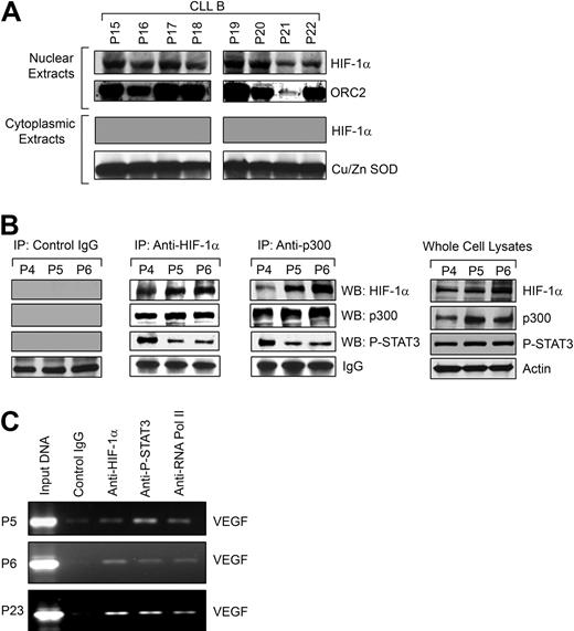 Figure 4. HIF-1α is functionally active in CLL B cells. (A) HIF-1α accumulates in the nuclei of CLL B cells. Nuclear extracts prepared from freshly isolated CLL B cells (n = 8) were analyzed for nuclear accumulation of HIF-1α by Western blot. An antibody to ORC2 was used for the purity of nuclear preparation. Analysis of the cytoplasmic fractions for HIF-1α was also performed by Western blot. An antibody to Cu/Zn SOD was used to indicate the purity of the cytoplasmic preparations. (B) HIF-1α forms a complex with p300 and P-STAT3. Freshly isolated CLL B-cell lysates (P4-6) were used to immunoprecipitate HIF-1α or p300 using specific mouse monoclonal antibodies. Mouse whole immunoglobulin (IgG) was used as control antibody for immunoprecipitation. The immunoprecipitated complexes were subjected to Western blot analyses using specific antibodies to p300, phospho-STAT3, or HIF-1α, as indicated. Endogenous expression levels of HIF-1α, p300, and phospho-STAT3 in the CLL B-cell lysates used in these experiments are shown by Western blot analyses using specific antibodies. Actin was used as the loading control. (C) HIF-1α and P-STAT3 form an active complex at the VEGF promoter in CLL B cells. Chromatin immunoprecipitation assay was performed with an antibody to HIF-1α, phospho-STAT3, or phospho-RNA polymerase II or control mouse IgG using the cross-linked nuclear extracts from CLL B cells (P5, P6, and P23) as described in “ChIP assay.” The immunoprecipitated DNA was purified and the region from −1386 to −1036 bp of the human VEGF promoter was amplified by PCR. Input DNA is indicated.