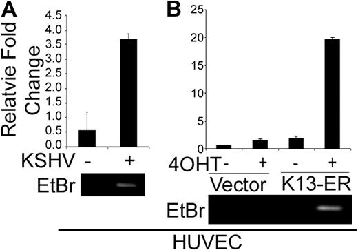 Figure 6. KSHV infection and K13 expression induce the expression of CCL20 receptor CCR6 in HUVECs. Quantitative RT-PCR analysis showing induction of CCR6 mRNA in HUVECs after infection with KSHV (A) and in HUVEC-K13-ERTAM cells on treatment with 4-OHT (B). The experiments were performed essentially as described in Figures 1A and 2A, respectively.