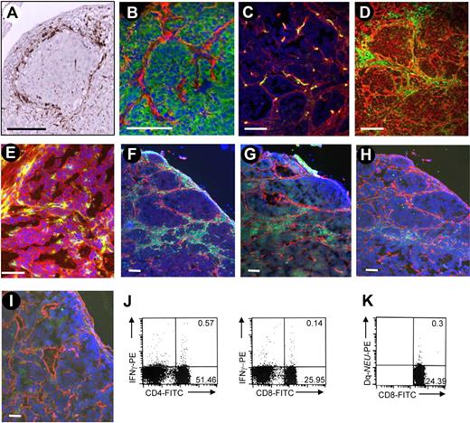 Figure 1. Analysis of tumor-infiltrating cells in human and mouse tumors. (A) Tumor sections from patients with breast cancer were stained for the macrophage marker CD68 (brown) and counterstained with hematoxylin. (B-I) Sections of subcutaneous MMC tumors in neu-tg mice. Tumors were analyzed 3 weeks after MMC transplantation. (B) Adherens junction marker E-cadherin (green) and stroma marker laminin (red); (C) endothelial marker CD31 (green) and laminin (red); (D) panleukocyte marker CD45 (green) and laminin (red); (E) CD45 (green) and relaxin receptor (red); (F) macrophage marker F4/80 (green) and laminin (red); (G) CD4 T-cell marker (green) and laminin (red); (H) CD8 T-cell marker (green) and laminin (red); (I) NK cell marker NK1.1 (green) and laminin (red). Nuclei are stained with DAPI (blue). The scale bar represents 100 μm. (J) Quantification of immune cells in tumor-draining lymph nodes. Intracellular cytokine staining for IFNγ and CD4, using anti–IFNγ-PE antibodies and anti-CD8, anti–CD4-FITC antibodies. (K) Quantification of immune cells in tumor-draining lymph nodes. Frequency of Neu-specific CD8+ cells in splenocytes was determined by Tetramer assay.26 Characteristic samples are shown. The numbers in the quadrants represent the precentage of positive cells.