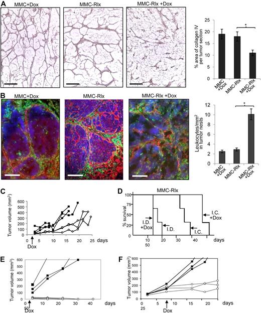 Figure 2. Rlx-mediated stroma degradation in subcutaneous tumors mediates antitumor responses. (A,B) MMCs transduced with lentivirus vectors expressing mouse Rlx under Dox control (MMC-Rlx) or unmodified MMCs were used to establish tumors in neu-tg mice. Two days after transplantation, Dox was added to drinking water for selected groups of animals. Tumors were harvested 3 weeks after cell implantation, and tumor sections were analyzed for collagen IV (A) and laminin/CD45 (B). The scale bar represents 100 μm. Morphometry for collagen IV and quantification of CD45+ cells in tumor nests are shown on the right sides. Error bar represents SD. (C) Tumor size of MMC-Rlx tumors in neu-tg mice with Dox (○) and without Dox (■) treatment was measured over a period of 45 days. Each line represents one mice. (D) Kaplan-Meyer survival study in neu-tg mice (I.C. indicates immunocompetent) and CB17 SCID/beige (I.D. indicates immunodeficient) mice bearing MMC-Rlx tumors with and without Dox treatment (started at day 2 after tumor cell implantation.) Tumor size was measured daily. End point was the day when tumors reached a size of 1000 mm3 (n = 7 per group). (E) Tumor growth after injection of MMC-Rlx29 without Dox (■) and with Dox (○) treatment that was started at day 2 after tumor cell implantation. (F) Tumor growth after injection of MMC-Rlx29 without Dox (■) and with Dox (○) treatment that was started when tumors reached a size of approximately 70 mm.3