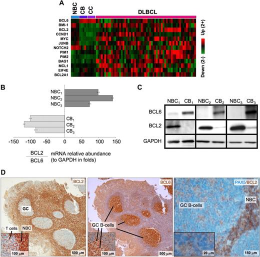 Figure 4. BCL6 represses many oncogenes in centroblasts. (A) A heatmap is shown representing the transcript abundance (data from Basso26) of oncogenes and related genes that are direct transcriptional targets of BCL6 (NBC indicates naive B cells; CB, centroblasts; and CC, centrocytes). (B) The relative ratio of BCL2 to BCL6 mRNA abundance versus GAPDH was measured in 3 independent sets of human tonsilar NBC and CBs by quantitative PCR (error bars represent the SEM for triplicates), and (C) Western blots. (D) Human tonsil sections were submitted to immunohistochemistry with BCL2 and nuclear counterstain (right panel and inset), BCL6 antibody and counterstain (middle), and with PAX5 and BCL2 costaining. The data show inverse staining patterns of BCL6 and BCL2 in GCs and show that the PAX5-positive GC B cells lack BCL2, indicating the BCL2-positive GC cells are not of the B-cell lineage. Slides were viewed with a light microscope (AxioSkop2; Carl Zeiss Microimaging, Thornwood, NY) using Plan-Neofluar lens at a 10×/0.50 air objective, 40×/0.90 oil objective, 100×/1.30 oil objective. Images were taken using a color camera (AxioCam; Carl Zeiss Microimaging) and were processed using Axiovision software (Carl Zeiss Microimaging).
