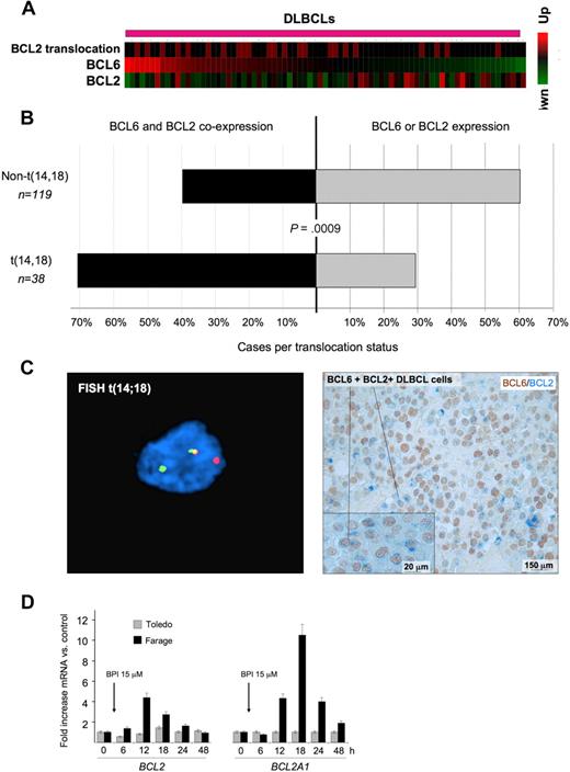 Figure 5. BCL6 and BCL2 inverse correlation is disrupted in patients with BCL2 translocations. (A) A series of DLBCLs (columns) is plotted in a heatmap and distributed according to their abundance of BCL6 transcript (data from Lenz et al33). BCL2 mRNA is generally negatively correlated with BCL6. Cases with BCL2 translocations are indicated by the red boxes in the top row. (B) Expression of BCL2 and BCL6 was examined in a series of 157 DLBCL patients by immunohistochemistry. The top bar represents patients without BCL2 translocation; bottom bar, BCL2 translocated cases. In each case, the black bar represents the percentage of patients who express both BCL6 and BCL2, whereas the gray bar represents the percentage of tumors that express either BCL2 or BCL6 exclusively. (C) Immunohistochemistry shows that DLBCL cases with t(14;18) translocations (left panel) typically exhibit malignant cells with dual BCL2 (blue) and BCL6 (brown) protein expression (right panel). FISH results were visualized using a Zeiss LSM510 Multiphoton confocal microscope (Carl Zeiss Microimaging) equipped with 40×/0.75/0.72 and 60×/0.80/0.3 objectives and one 25-mW argon laser exciting at 458, 488, and 514 nm and one 1-mW helium-neon laser exciting at 543 nm; proprietary image acquisition software was used for image analysis. (D) The DLBCL cell lines Farage (which expresses BCL6 and has wild-type BCL2 locus) and Toledo (which is BCL6-negative) were exposed for the indicated times to the specific BCL6 peptidomimetic inhibitor RI-BPI. The y-axis represents the fold increase of mRNA change induced by RI-BPI versus a control peptide. Cells were treated as indicated, and the data were from 3 independent experiments. Error bars represent the SEM for triplicates.