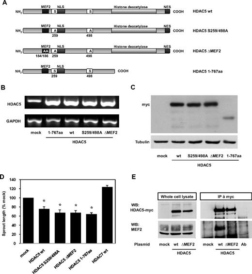 Figure 2. Mechanism underlying the antiangiogenic function of HDAC5. (A) Scheme of different HDAC5 constructs. (B) RT-PCR analysis of HUVECs overexpressing different HDAC5 constructs after 14 hours. (C) Western blot analysis of HUVECs overexpressing different HDAC5 constructs after 14 hours. (D) Capillary-like sprout formation from spheroid cultures of HUVECs overexpressing different HDAC5 constructs (n = 3-10; *P < .05 vs mock). (E) Lysates of HUVECs overexpressing different HDAC5 constructs were immunoprecipitated with an antibody against c-myc. Western blots were performed with an anti-c-myc or an anti-MEF2 antibody in whole cell lysates or after immunoprecipitation. Ab indicates antibody control.