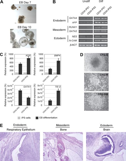 Figure 2. In vitro and in vivo differentiation potential of the CD34 iPS cells. (A) Embryoid body-mediated differentiation of CD34 iPS cells. Differentiation of embryoid bodies (EB) consisting of tight clusters of differentiating cells was observed by day 7 and will cavitate, becoming cystic, by day 10. Images were acquired with a standard microscope (Nikon) with a 10× objective. (B) In vitro-differentiated human CD34 iPS cells demonstrate gene expression from all 3 embryonic germ layers. Semiquantitative RT-PCR performed on undifferentiated (U) and embryoid body-differentiated (D) iPS cells shows up-regulated expression of lineage markers from the 3 embryonic germ layers (endoderm, GATA4 and AFP; mesoderm, RUNX1 and GATA2; and ectoderm, NESTIN and N-CAM). β-ACTIN is shown as a positive amplification and loading control. (C) In vitro–differentiated human CD34 iPS cells demonstrate gene expression of hematopoietic lineage markers. Semiquantitative RT-PCR performed on undifferentiated iPS cells and embryoid bodies differentiated in hematopoietic inducing medium shows up-regulated expression of KDR, BMP4, GATA1, and TIE-2. (D) Embryoid bodies derived from CD34 iPS cells yield myeloid colonies in semisolid methylcellulose media: colony-forming unit-granulocyte (CFU-G), colony-forming unit-macrophage (CFU-M), and colony-forming unit-granulocyte macrophage (CFU-GM). Images were acquired with a standard microscope (Nikon) with a 20× objective. (E) Hematoxylin and eosin staining of teratomas derived from immunodeficient mice injected with human CD34 iPS cells shows tissues representing all 3 embryonic germ layers, including respiratory epithelium (endoderm), bone (mesoderm), and immature neural tissue (ectoderm).