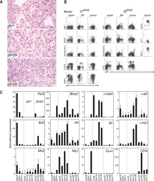 Figure 3. Characterization of rare Blimp1gfp/gfp tumors. (A) Representative histologic appearance of tumors by Blimp1 genotype. (Top) PCT in a Blimp1gfp/+ mouse, characteristic of tumors seen in all Blimp1+/+ and Blimp1gfp/+ mice. (Middle) Reticulum cell sarcoma, as seen in 4 Blimp1gfp/gfp mice. (Bottom) Lymphoid leukemia in Blimp1gfp/gfp mouse no. 28. Images were viewed using a Zeiss Axiophot microscope (Oberkochen, Germany) with a Plan-apo 20×/0.60 objective and hematoxylin and eosin stain and captured with a Zeiss Axiophot camera. (B) Flow cytometric analysis of BM, spleens, and enlarged LN (“tumors”) of 2 representative Blimp1gfp/gfp mice that developed tumors. The tissues of mouse no. 21 had a pattern characteristic of mice that bore reticulum cell sarcomas (nos. 17, 21, and 22). Mouse no. 28 had a lymphoid leukemia. The panel on the right for mouse no. 28 is gated on GFP+ cells in the tumor. (C) Quantitative reverse transcription PCR measuring expression levels of genes in normal resting B cells, GFP− B-cell blasts, GFP+ plasmablasts generated in vitro (27) and GFP+ cells sorted from 4 Blimp1gfp/+ and all 5 Blimp1gfp/gfp tumors. Note that the Blimp1 PCR amplifies exons that are not affected by the Blimp1/GFP modification, so both Blimp1+ and Blimp1gfp alleles are detected.