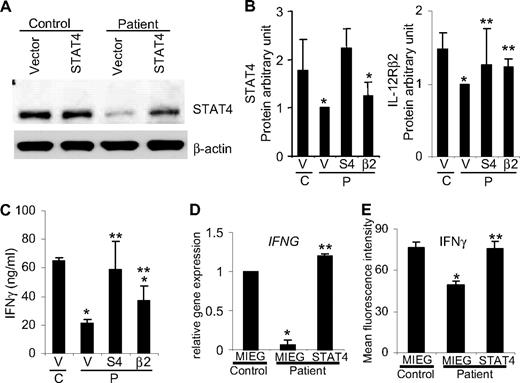 Figure 2. Reconstitution of STAT4 and IL-12Rβ2 expression in differentiated Th1 cells. Th1 cells after 1 week of differentiation from control and posttransplantation patients were transiently transfected with plasmids encoding human STAT410 (S4), IL-12Rβ211 (β2), or vector alone using a Human T cell Nucleofector Kit (Amaxa). Protein expression was analyzed by Western blot 3 days after transfection from total cell populations using anti-STAT4 (C-20; Santa Cruz Biotechnology) and antihuman IL12Rβ2 (R&D Systems) antibodies. (A) Representative immunoblot of STAT4 protein expression. (B) Immunoblot band intensity was quantified by densitometry, normalized to GAPDH (Cell Signaling, Beverly, MA), and expressed as the ratios of STAT4 or IL-12Rβ2 to GAPDH. The protein levels are expressed in arbitrary units and presented as mean plus or minus SD of 4 independent experiments. (C) One day after transient transfection, as in panels A and B, cells were washed and stimulated with anti-CD3 plus IL-12 (2 ng/mL). After 2 days of stimulation, IFNγ levels in supernatants were measured using ELISA and presented as mean ± SD of 4 independent experiments. In panels B and C, there was a total of 5 healthy controls and 12 patient samples (2-5 pooled/experiment) across 4 independent experiments. (D) Th1 cells cultured for 1 week were transduced with retroviruses encoding STAT4 and EGFP or EGFP alone. At the end of the second week of differentiation, EGFP-positive cells were sorted and total RNA was extracted to analyze IFNG and IL12RB2 gene expression by real-time PCR.9 Results shown are mean ± SD from a total of 2 healthy control and 7 patient samples (2-5 pooled/experiment) across 2 independent experiments. (E) Intracellular cytokine staining was performed on transduced cells in panel D with anti-CD3 (4 μg/mL) plus IL-12 (2 ng/mL) for 5 hours of stimulation in the presence of monensin at the last 2 hours of incubation. Expression of IFNγ was evaluated on 5000 events of GFP-positive cells by flow cytometry and presented as mean fluorescence intensity (MFI). Values are presented as mean MFI ± SD from a total of 4 healthy control and 6 patient samples (2 pooled/experiment) across 3 independent experiments. For all panels: *Significantly different from healthy controls (P < .05); **significantly different from patients (P < .05).