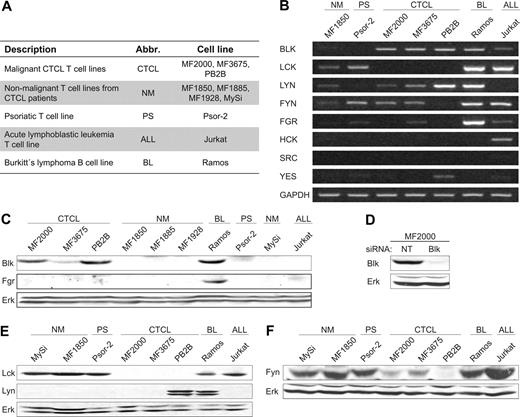 Figure 1. Malignant CTCL cell lines selectively express Blk. (A) Descriptions and abbreviations (Abbr.) of the cell lines used in the study. (B) RT-PCR and (C,E,F) WB analyses of the expression of SFKs in the cell lines shown in panel A. (D) MF2000 cells were transiently transfected with nontargeting (NT) or Blk-specific siRNA, and the expression of Blk and Erk was determined by WB 48 hours after transfection.