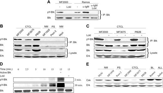 Figure 4. Blk is constitutively active in malignant CTCL cell lines. (A) Malignant CTCL cells (MF2000) and Ramos B cells were incubated without (−) or with LckI (10 μM) for 30 minutes. Then, 20 μg/mL goat anti–human IgM F(ab′)2 fragments (α-IgM) were added as indicated, and the cells were incubated for 5 minutes further. Subsequently, the cells were lysed, and Blk was immunoprecipitated (IP) from the total cell lysates. Finally, the levels of pY-Blk and Blk were determined by WB using phosphotyrosine and Blk-specific antibodies, respectively. (B) Blk was immunoprecipitated from total cell lysates of malignant (CTCL) and nonmalignant (NM) cell lines as well as from a psoriatic T-cell line (PS). Both total cell lysates (Lysate) and immunoprecipitated Blk (IP: Blk) were analyzed by WB using antibodies against phosphotyrosine (pY-Blk), Blk, and Erk. (C) Malignant CTCL cell lines were incubated for 30 minutes with LckI (10 μM) or vehicle (−). Then immunoprecipitated Blk and respective total cell lysates were analyzed by WB. (D) MF2000 cells were incubated with LckI (10 μM) for 30 minutes and lysed, and Blk was immunoprecipitated from the total cell lysates. The precipitated Blk was incubated for different time intervals (minutes) in kinase buffer without or with LckI (2 μM) and constitutive active Blk (1 ng/μL) as indicated. The levels of pY-Blk and Blk were analyzed by WB. For pY-Blk, films exposed for 2 or 10 minutes are shown. (E) WB analysis of Csk and Erk expression in the indicated cell lines.