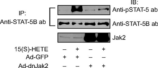 Figure 3. Blockade of Jak2 activation inhibits 15(S)-HETE–stimulated STAT-5B phosphorylation. HRMVECs were transduced with Ad-GFP or Ad-dnJak2 at 80 MOI, quiesced, and treated with and without 15(S)-HETE (0.1 μM) for the indicated time periods, and cell extracts were prepared and analyzed by Western blotting for tyrosine phosphorylation of STAT-5B, as described in Figure 2A legend (top panel). The blot was reprobed with anti–STAT-5B antibodies for normalization (middle panel). The same samples were analyzed by Western blotting using anti-Jak2 antibodies to show the overexpression of dnJak2 (bottom panel).