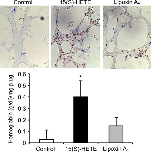 Figure 8. LXA4 fails to induce angiogenesis. C57BL/6 mice were injected subcutaneously with 0.5 mL of Matrigel premixed with vehicle or 5 μM 15(S)-HETE or 5 μM LXA4. One week later, the animals were killed and the Matrigel plugs were harvested from underneath the skin, and cryosections were either made and immunostained for CD31 using anti-CD31 antibodies or analyzed for hemoglobin content using Drabkin reagent. The values in the bar graph are the mean plus or minus SD of 6 plugs from 6 animals. *P < .01 versus vehicle control.