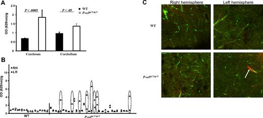 Figure 1. Increased BBB permeability in P-selΔCT/ΔCT mice. (A) Quantification of EBD accumulation in the brain of P-selΔCT/ΔCT mice compared with WT. Data represent EBD extravasation calculated from A620 OD/g. n = 17 for WT and n = 31 for P-selΔCT/ΔCT mice. (B) Comparison of EBD accumulation between the right (RH, ▴) and left hemisphere (LH, ▵) in each animal. Ovals indicate the animals with a difference between RH and LH. (C) Representative images from confocal microscopy in the cortex of 4- to 5-month-old mice injected with EBD (red) 6 hours before perfusion with large dextran (green) at the time of sacrifice. Top panels show section of cerebrum from a WT; bottom panels are from P-selΔCT/ΔCT mice. Arrow points to the accumulation of EBD outside of the vessel in the left hemisphere of the P-selΔCT/ΔCT mice. Data represent mean ± SEM.