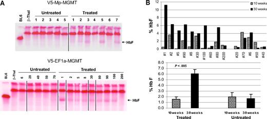 Figure 2. In vivo selection results in significant increases in HbF in mice transplanted with γ-globin/MGMT lentiviral vector transduced β-thalassemic BM cells. (A) Cellulose acetate gel electrophoresis of RBC lysates from individual mice transplanted with V5-Mp-MGMT vector-transduced β-thalassemic cells (top panel) or V5-EF1-MGMT vector-transduced β-thalassemic cells (bottom panel) and either not treated or administered drug treatment as indicated in the Figure 1 legend. Vertical lines have been inserted to indicate a repositioned gel lane. (B) HbF levels as determined by quantitative HPLC are shown for individual mice transplanted with V5-EF1-MGMT–transduced β-thalassemic cells and left untreated or after drug selection, as indicated. Data represent the mean ± SEM. Statistically significant differences are indicated by the P value, as determined by the Student t test.