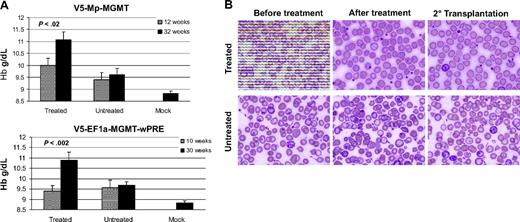 Figure 3. Amelioration of the anemia and RBC morphologic abnormalities of β-thalassemia after in vivo selection of mice transplanted with γ-globin/MGMT lentiviral vector-transduced cells. (A) Hb levels in the indicated groups of control, untreated and drug-treated animals, both before and after drug administration. Values are also shown for mice transplanted with mock-transduced β-thalassemic cells at 32 weeks after transplantation. Data represent the mean plus or minus SEM. Statistically significant differences are indicated by the P values, as determined by the Student t test. (B) Wright-Giemsa–stained blood smears are shown for a representative treated and untreated animal transplanted with V5-EF1-MGMT-transduced β-thalassemic cells, as indicated. Photomicrographs were generated using an Olympus microscope (model BX60F-3; Tokyo, Japan) and an Olympus digital camera (model DP71), 100×/1.3 NA oil objective.