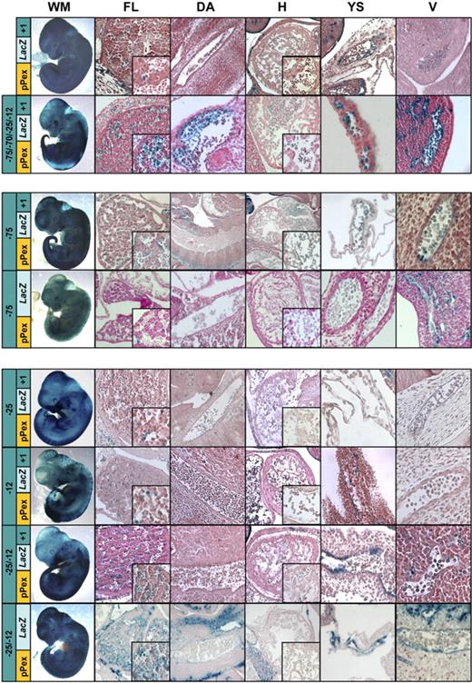 Figure 5. Transgenic analysis of multienhancer constructs reveals distinct combinations able to drive expression to circulating erythroid or FL cells. Whole-mount staining (WM) and histologic sections of FL, dorsal aorta (DA), heart (H), yolk sac (YS), and peripheral vessels (V) from transgenic embryos harvested between E11.5 and E12.5. X-Gal reporter expression driven by the LMO2 1.3-kb extended pP (pPexLacZ) combined with candidate hematopoietic enhancers. The +1 construct is characterized by reduced endothelial and hematopoietic activity compared with pPex alone (Figure 3A). Addition of 5 putative hematopoietic enhancer elements (−75/−70/−25/−12/+1) induce specific expression in circulating erythrocytes and enhanced staining of FL. Systematic exclusion of elements −70, −25, and −12 reveals that the erythroid-specific expression can be attributed to the element −75, possibly in combination with element +1 (see −75 pPexLacZ+1 and −75 pPexLacZ). Robust FL expression, on the other hand, is conferred by collaboration of elements −25 and −12 (see −25 pPexLacZ+1, −12 pPexLacZ+1, −25/−12 pPexLacZ+1, and −25/−12 pPexLacZ).