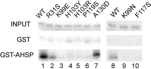 Figure 2. In vitro interactions of WT and mutant α globins with AHSP-GST. 35S-radiolabeled mutant α globins were synthesized by transcription coupled translation (TNT) with CN-hemin present, incubated with GST or GST-AHSP Sepharose beads, fractionated by SDS-PAGE, and visualized by autoradiography. Input controls (not incubated with beads) are shown in the top panel.