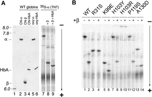 Figure 3. Monomer shift assay to examine interactions of mutant α globins with β globin. (A) IEF (pH 6-8) of purified and in vitro-synthesized WT hemoglobins. (Left panel) Hemoglobins purified from human blood were fractionated by IEF and stained with Coomassie blue. Each lane contains 10 μg of purified protein. (Right panel) WT 35S-α globin was synthesized by TNT with CN-hemin present and then unlabeled oxygenated β Hb subunit (20 nM final concentration) with or without HbA (5 μg = 3.1 μM final concentration in 25 μL) were added. The mixtures were fractionated by IEF and 35S-labeled α globin complexes were detected by autoradiography. pH markers and the positions of purified hemoglobins are indicated on the left. As described in the text, purified α globin (lanes 2 and 6) migrates slightly faster than TNT-synthesized 35S-α globin (lane 7) probably the result of posttranslational modification(s) that are specific to the TNT reaction. Also note that addition of excess HbA drives 35S-α globin-β globin dimers into mixed HbA tetramers, which have a slightly lower pI than the αβ dimers (compare lanes 8 and 9). (B) WT and mutant 35S-radiolabeled α globins were synthesized by TNT with CN-hemin present, and then unlabeled oxygenated β Hb subunit (20 nM) was added. The mixtures were fractionated by IEF (pH 6-8) and radiolabeled α globin (either free or in the context of α1β1 heterodimers) was visualized by autoradiography. (−) indicates no β globin added; and (+), β globin added.