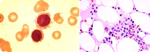 Neil Abramson, Baptist Cancer Institute, University of Florida-Jacksonville