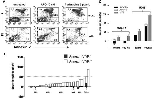 Figure 1. Cytotoxic activity of APO866 in primary leukemia cells, MOLT4, and U266 cells. (A) Primary B-CLL (> 80% CD19+ cells, n = 23), T-CLL (> 90% CD3, CD2, CD5, CD7+, n = 1), and AML (> 70% blasts, n = 5) cells were isolated from peripheral blood (PB) samples by density gradient centrifugation. 106 cells/well were seeded in 24-well plates and cultured with or without 10 nM APO866 or 5 μg/mL fludarabine. Ninety-six hours later cells were harvested, washed, stained with fluorescein isothiocyanate (FITC)–conjugated annexin-V and PI, and analyzed by flow cytometry. (B) Quantification of early apoptotic (annexin-V+/PI−) and late apoptotic/necrotic (annexin-V+/PI+) cells on exposure to 10 nM APO866. The percentage of early apoptotic cells is shown as ▬ while late apoptotic cells are shown as ▭. (C) 3 × 104 MOLT4 and U266 cells/well were plated in 96-well plates and incubated with or without APO866 at the indicated concentrations for 96 hours. Thereafter, cell death was quantified by MTT colorimetric assay, and by AV/PI staining and flow cytometry. Results are presented as means of triplicate wells and SD.