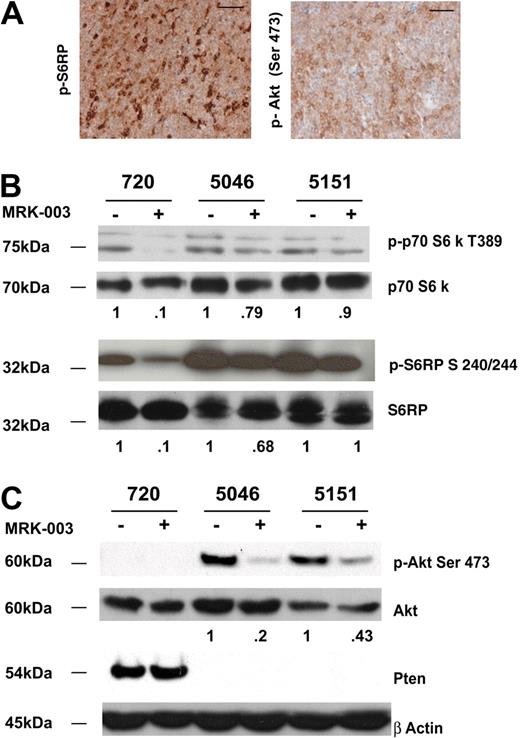 Figure 5. The mTOR pathway is activated in all mouse T-ALL cell lines examined. (A) Primary mouse T-ALL tumors exhibit activation of Akt and mTOR pathways. Thymomas from vehicle-treated mice were harvested at killing and tumor sections were fixed in 10% buffered formalin. Sections were then stained with antibodies to phospho-S6 ribosomal protein (p-S6RP) or phospho-Akt (Ser473). Scale bars represent 50 μM. (B) Reduced levels of mTOR substrates are observed when mouse T-ALL lines are treated with GSI. Primary murine leukemic lines were treated with 1 μM MRK-003 or DMSO for 48 hours. MTOR activity was assayed by immunoblotting cell lysates with anti–phospho-p70 S6 kinase or phospho-S6 ribosomal antibodies (no. 9205, no. 2215; Cell Signaling Technology). p70 S6 kinase and S6 ribosomal were used as loading controls (no. 9202, no. 2217; Cell Signaling Technology). (C) Notch1 regulates Akt activity in some mouse T-ALL lines. Primary murine leukemic lines were treated with 1 μM MRK-003 or DMSO for 48 hours. Akt activity was assayed by immunoblotting cell lysates with anti–phospho-Akt Ser 473 antibody (no. 9271; Cell Signaling Technology). Akt was used as a loading control (no. 9272; Cell Signaling Technology). Fold reductions in kinase activity were determined by densitometry and represent ratios (phospho/total) normalized to DMSO-treated samples.