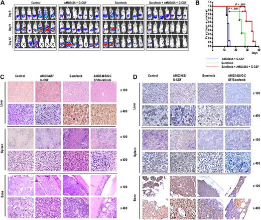 Figure 6. In vivo effects of AMD3465/G-CSF and sorafenib in a mouse xenograft model of FLT3-ITD mutant leukemia. (A) Serial bioluminescence images of mice in the groups receiving sorafenib, AMD3465/G-CSF, sorafenib combined with AMD3465/G-CSF, or in the group without any treatment (control) were taken on days 6, 9, and 12 after tumor cell injection. Deceased mice are identified by “X” sign. (B) Overall survival in each group was estimated by Kaplan-Meier method. Statistical significance was calculated using the log-rank test. (C,D) Histologic sections of liver, spleen, and bone marrow of mice stained with H&E (C) or anti-GFP antibody (D) in untreated mice (day 13), AMD3465/G-CSF (day 14), sorafenib (day 14), or AMD3465/G-CSF + sorafenib (day 14) treated mice.