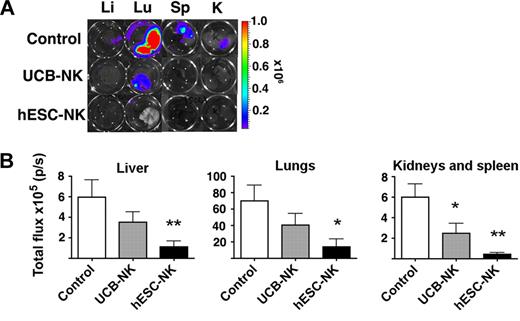 Figure 3. hESC-derived NK cells protect against K562 metastasis. (A) Representative images of micrometastasis foci in liver, lungs, spleen, and kidneys as identified by bioluminescent imaging. (B) Quantification of luciferase activity (p/s) from isolated organs. Luciferase intensity from each well was quantified using LivingImage software. Mean ± SEM from indicated organs is shown.