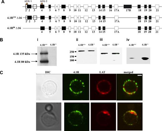 Figure 1. Expression and localization of 4.1R in mouse CD4+ T cells. (A) Exon composition of 4.1R isoforms. Schematic representation of the exon map of 4.1R is displayed in the top panel. Two translation initiation sites are indicated. Alternatively spliced exons are shown in black, constitutive exon in gray, and noncoding exons in open boxes. Exon compositions of 4.1R 135 kDa and 80 kDa are shown in the middle and bottom panels, respectively. (B) Western blot analysis of protein 4.1 members. CD4+ T cells (106 cells) purified from 4.1R+/+ or 4.1R−/− T lymph nodes were subjected to immunoblot analysis with polyclonal rabbit antibodies against 4.1R exon 13 (i), 4.1B headpiece (ii), 4.1G headpiece (iii), and 4.1N headpiece (iv). The positions of approximately 135 kDa and approximately 80 kDa 4.1R are indicated. Note that, although 4.1B and 4.1G are unchanged, 4.1N expression is up-regulated in 4.1R−/− CD4+ T cells. (C) Localization of 4.1R in T cells. Unstimulated and stimulated primary mouse T cells were doubled stained with anti-4.1R exon 13 and anti-LAT antibodies and analyzed by confocal microscopy. In unstimulated samples, protein 4.1R is evenly distributed in discrete puncta around the cell membrane where it dose not colocalize with LAT. After stimulation, both protein 4.1R and LAT become enriched at the interface between T cell and bead where they colocalize. Scale bar, 2 μm.