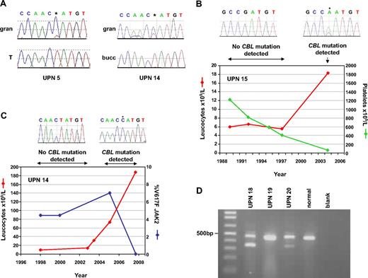 Figure 4. Acquisition of CBL mutations. (A) Comparison of granulocytes (gran) with buccal epithelial cells (bucc) or T cells (T) demonstrates that the L380P mutations in cases UPN 5 and 14 are acquired. (B) Sequential leukocyte and platelet counts for case, who presented in 1989 with essential thrombocythemia (ET) but progressed to myelofibrosis (MF) in 2004. Homozygous CBL R420Q, indicated by *, was detected on transformation but was undetectable in previous specimens. (C) Clinical course of case UPN 14, who presented with MF in 1998 but experienced elevated leukocyte counts in 2005, concomitant with the appearance of the CBL L380P mutation. The JAK2 V617F mutation, which had been present at low level since diagnosis, was still detectable when CBL L380P first appeared but was undetectable in the 2008 sample, when the CBL mutated clone predominated (* on sequence trace). (D) RT-PCR analysis. All cases and controls show the expected product from CBL exons 7-10. Cases UPN 18 and UPN 20 show smaller bands that result from complete deletion of exon 8.