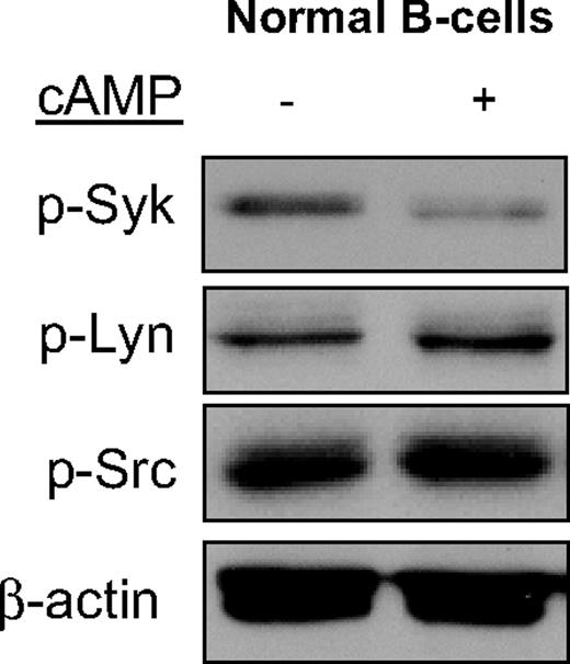 Figure 2. cAMP specifically inhibits SYK phosphorylation in normal mature B cells. Phosphorylation of SYK, but not of the LYN and SRC kinases, was significantly inhibited by cAMP in highly purified murine normal mature B cells. β-Actin immunoblotting confirms equal loading.