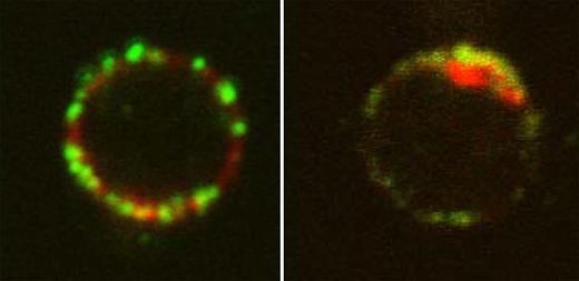 Localization of 4.1R in T cells. See the complete figure in the article beginning on page 6128.