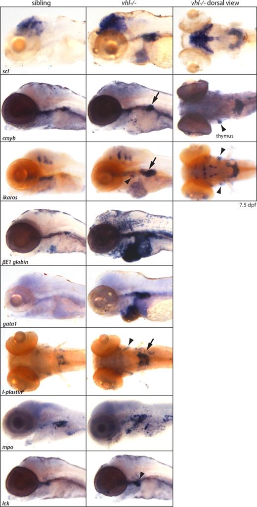 Figure 4. Global up-regulation of red and white hematopoietic lineages in vhl mutants. In situ hybridizations reveal a global up-regulation of both red and white hematopoietic lineages, as shown at 7.5 dpf. Increased expression of red lineage markers scl/tal-1 (HSC, erythrocytes), c-myb (HSC), gata1 (immature erythrocytes), and βE1 globin (differentiated erythrocytes), and white lineage markers ikaros (immature lymphocytes), lck (differentiated lymphocytes), mpo (neutrophils), and l-plastin (monocytes) is observed, predominantly in the horseshoe-like PHT (→) adjacent to the glomerulus. c-myb, ikaros, lck, and l-plastin are also expressed in the bilateral thymus (). Accumulated blood cells in the heart remain scl, ikaros, and βE1 globin positive. Original magnification ×5.