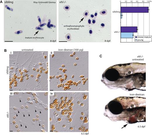 Figure 5. vhl mutants display an altered blood composition and develop anemia. (A) May-Grünwald-Giemsa–stained blood smears of 8 dpf vhl mutants and siblings. Relative to the number of (more) mature erythrocytes, vhl mutants display a marked increase in circulating orthochromatophilic erythroblasts (40%, n = 9) compared with siblings (5%, n = 9). Similar to human embryonic blood, zebrafish erythrocytes are nucleated. The cytoplasm of the morphologically more mature vhl−/− erythrocytes appears paler (hypochromic). (B) To investigate whether vhl mutants are iron deficient, blood cells were stained with o-dianisidine. Whereas in siblings uniformly stained dark brown erythrocytes are observed (Bi), in vhl mutants no () or variable heme levels are detected at 6.5 dpf (Biii). Injection of 100 mM iron-dextran at 2 dpf rescued the observed anemic phenotype (Biv). (C) Rescue is even observed in live vhl mutants by darker red circulating blood cells. Original magnifications, ×40 (A,B) and ×5 (C). Scale bar indicates 25 μm.
