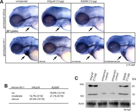 Figure 6. Human VHLp30 mRNA rescues vhl−/− polycythemia. (A,B) Embryos were injected with 7.5 pg of either full-length human VHLp30 or VHL R200W mRNA at the 1-cell stage. Whereas at 3.75 dpf only a few βE1 globin+ blood cells are observed in siblings, uninjected vhl mutants show a strong overexpression of βE1 globin mRNA that is most clearly visible in the blood cells accumulated in the heart (). After VHLp30 mRNA injection, this is not observed in 83.3% (15 of 18) of the genotyped vhl mutants, indicating a nearly complete rescue of the polycythemic phenotype by the human protein. Injection of VHL R200W mRNA could not restore the vhl−/− βE1 globin expression to wild-type levels. (C) Translation of VHLp30 and R200W mRNA is verified by Western analysis at 56 hpf. One lane represents 3 embryo equivalents. β-Actin is used as a loading control. Original magnification, ×5 (A).
