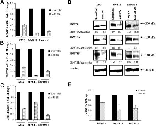 Figure 1. miR-29b targets DNMT1, DNMT3A, and 3B in AML cell lines and primary AML blasts. (A) DNMT3A, (B) DNMT3B, and (C) DNMT1 mRNA expression after nucleoporation (K562, MV4-11) or infection (Kasumi-1) of pre-miR-29b or their respective controls (scrambled oligonucleotides for K562 and MV4-11cells and empty vector lentivirus for Kasumi-1 cells). Histograms show fold changes (reduction) in mRNA expression with respect to the controls after normalization with 18s in 3 independent experiments. Bars represent SD. (D) DNMT1, DNMT3A, and 3B protein expression after pre-miR-29b or control nucleoporation or infection in K562, MV4-11, and Kasumi-1 cell lines. Equivalent gel loading was confirmed by probing with antibodies against β-actin. (E) DNMT1 and DNMT3A and 3B mRNA expression in primary AML patient samples (n = 3) after nucleoporation of pre-miR-29b or a scrambled oligonucleotide. Histograms show fold changes (reduction) in mRNA expression with respect to the control after normalization with 18s. Bars represent SD.