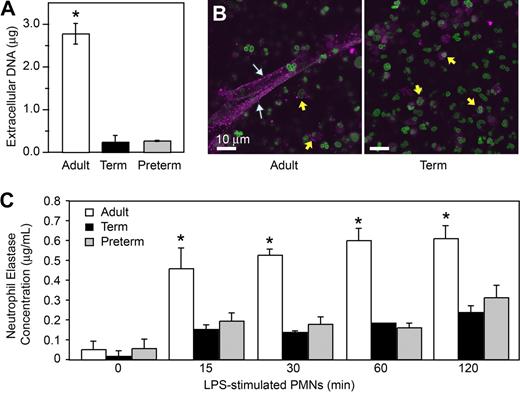 Figure 3. Stimulated PMNs from term and preterm infants extrude less DNA and release less neutrophil elastase, a surrogate marker of NET formation, than do PMNs from adults. (A) Supernatant DNA content was determined via fluorometry by quantitation of a non–cell-permeable DNA dye (Sytox Orange) in samples from PMNs stimulated with LPS (100 ng/mL) for 1 hour. The data are expressed as mean plus or minus SEM values for extracellular DNA. The asterisk indicates a significant difference (P < .001) between values from adult PMNs and those from term and preterm neutrophils. (B) NET-associated neutrophil elastase was examined by immunocytochemical analysis of PAF-stimulated and control PMNs from healthy adults and term infants. Stimulated PMNs from adults (left) extruded NETs that stained robustly for NE (magenta fluorescence; white arrows). Stimulated PMNs isolated from term infants (right) failed to form NET lattices containing extracellular NE. NE was detected in primary granules in PMNs from both term neonates and adults (yellow arrows). Extracellular and intracellular DNA counterstaining as in Figure 1 demonstrated both nuclear and, depending on the source of PMNs (adult vs neonate), extracellular NET-associated DNA. (C) NET-associated NE activity was determined in DNase-treated incubations of control PMNs and neutrophils stimulated with LPS (100 ng/mL) for 120 minutes. Mean plus or minus SEM NE concentrations are shown. The asterisk indicates a significant difference (P < .05) in NE concentration in DNase-treated samples from neonatal PMNs compared with the DNase-treated samples from adult PMNs. The images and data in Figure 3 are from a minimum of 3 separate experiments in each case.