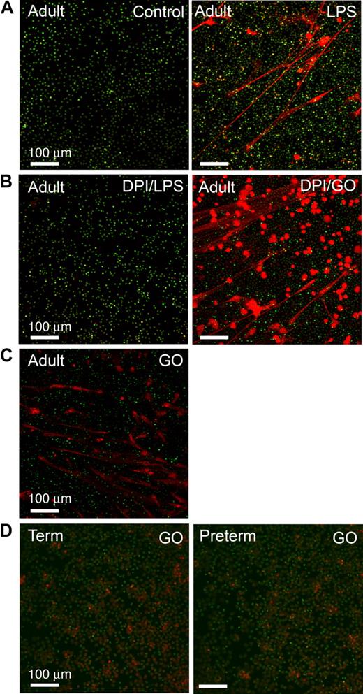 Figure 5. ROSs induce NET formation by adult PMNs but do not complement defective NET formation by PMNs isolated from newborn infants. NET formation was detected by live cell imaging with confocal microscopy (20× objective) using cell-permeant (green fluorescence) and impermeant (red fluorescence) DNA dyes as in Figure 1. All images are representative of 4 different experiments using PMNs from each subject group. (A) PMNs isolated from adults were incubated with buffer alone (control) or stimulated with LPS (100 ng/mL) for 60 minutes. (B) Adult PMNs were pretreated with DPI (20 μM) and then incubated for 60 minutes with either LPS (100 ng/mL) or exogenous ROSs generated by treatment with glucose/GO (1 mM/200 mU/mL). DPI inhibited endogenous ROS generation. (C) Adult PMNs were treated with glucose/GO (1 mM/200 mU/mL) alone without LPS or other agonist stimulation. (D) PMNs isolated from term (left panel) or preterm (right panel) infants were stimulated with exogenous ROSs by treatment with glucose/GO (1 mM/1000 mU/mL). Additional incubations using GO in concentrations from 200 mU/mL (ie, as with adult PMNs in panels B and C) to 1000 mU/mL yielded similar results (not shown).