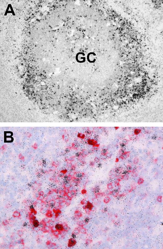 Figure 7. Localization and phenotype of EBV-positive cells in IM tonsil sections. (A) EBER-specific in situ hybridization with 35S-labeled RNA probes reveals numerous extrafollicular EBV-positive cells (black granular labeling). A small number of EBV-positive cells are also present within the GC. (B) Double labeling reveals that a proportion of extrafollicular EBV-positive cells (black) coexpress CD38 (red). Sections were examined under a Nikon Eclipse 80i microscope (Nikon GmbH, Dusseldorf, Germany) using either a Nikon Plan Apochromat 10×/0.45 objective lens (panel A) or a Nikon Plan Apochromat 40×/0.95 objective lens (panel B). Digital images were obtained with a Nikon Digital DS-5M camera and acquired using Digital Sight DS-5M-L1 image acquisition software.