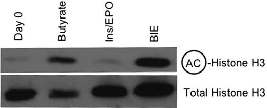 Figure 4. Bulk histone acetylation in eFLCs. Shown are Western blot analyses for total acetylated histone H3 with total histone H3 as a loading control, from E14.5 eFLCs harvested at day 0 or after 24 hours in culture, as indicated.