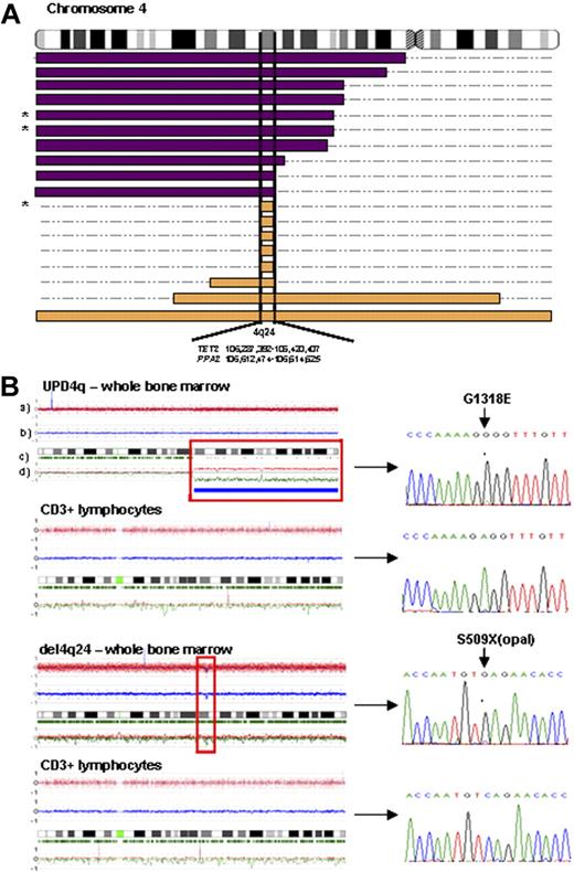 Figure 1. LOH 4q24 mapping and TET2 sequencing. (A) Topographical map illustrating overlapping regions of UPD4q24 (purple bars) and del4q24 (orange bars) in patients with myeloid malignancies. A minimally affected region on 4q24 (0.35 Mb), containing TET2 and PPA2, was identified in 18 of 398 patients studied (* indicates that some patients' DNA was not available for mutational screening; n = 3). (B) Representative examples of SNP-A karyograms (CNAG version 3.0) of chromosome 4 of both whole bone marrow cells and paired CD3+ lymphocytes in 2 patients, demonstrating the somatic nature of acquired LOH4q24 and TET2 mutations, which are shown in corresponding ferrograms in the right portion of the figure. SNP-A karyograms: rows a and b correspond to the copy number as measured by the intensity of individual hybridization signals; row c represents frequency of heterozygous calls; and row d indicates the allelic imbalance with parental allele copy numbers.