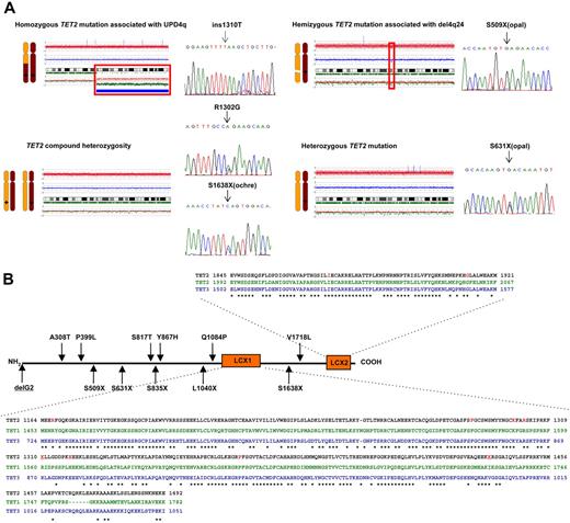 Figure 2. Identification of mutations in TET2 gene (4q24). (A) Genomic sequencing of all coding TET2 exons revealed the presence of nonsense, missense, and frameshift mutations. These mutations were homozygous and associated with UPD4q (top left), hemizygous associated with deletion (top right), or heterozygous associated with no chromosomal lesion (bottom right). Unique compound heterozygosity was found in 1 patient (bottom left). Detailed description of the SNP-A karyograms is provided in Figure 1B. (B) Schematic representation of the topographic distribution of the individual mutations in the TET2 protein (Isoform A NM_001127208). Amino acid sequences of TET family members are aligned (TET2, TET1, and TET3). *Highly conserved residues among all 3 proteins (LCXH domains). Most mutations were found in 2 conserved domains, LCXH 1 and 2 (50%, missense changes, frameshifts and codon stop changes are in red and underlined) while nonsense and frameshift mutations were more prominent in the N terminus (62%). Q1084P and Y867H are novel, unannotated SNPs (see “Note added in proof”).